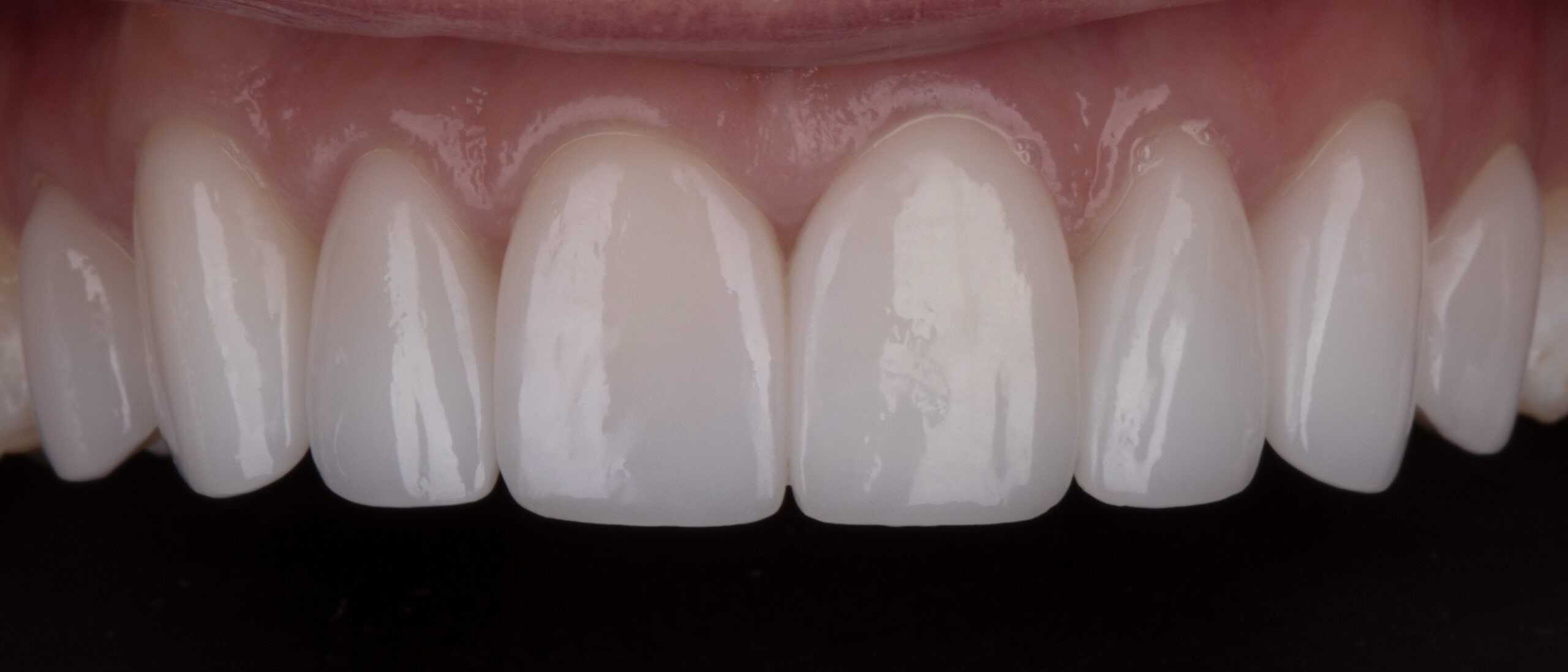 Cosmetic Dentistry